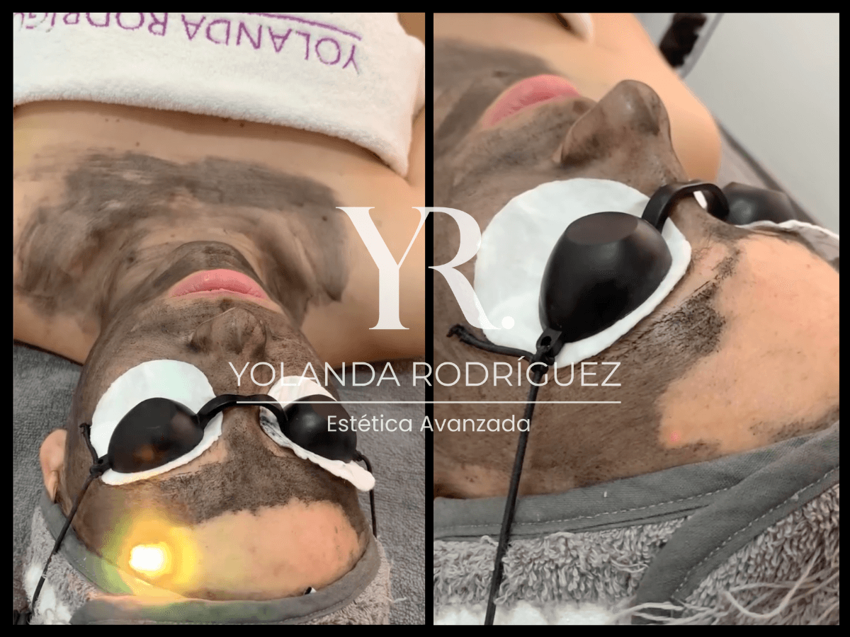Hollywood Peel - Yolanda Rodríguez