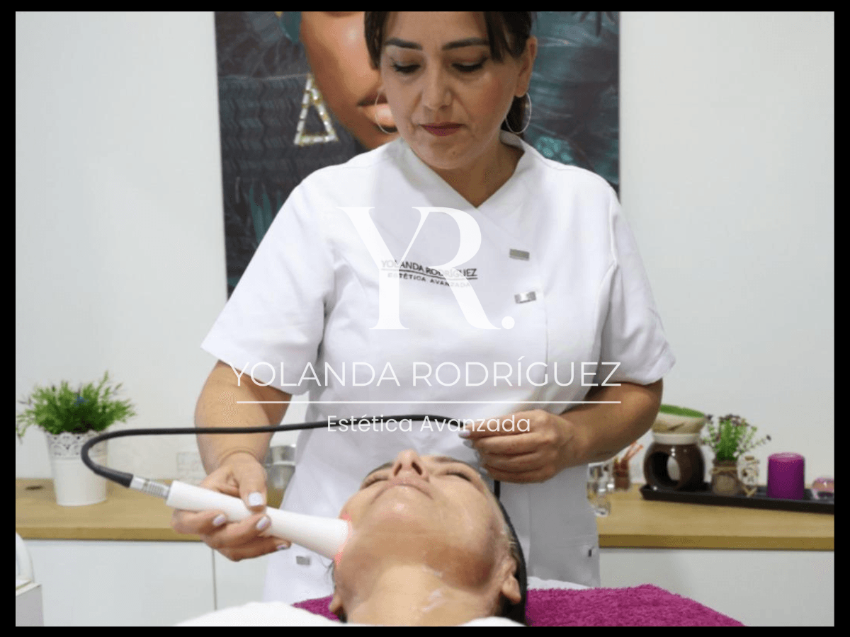 Radiofrecuencia Facial - Yolanda Rodríguez