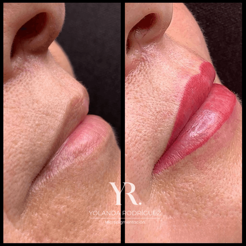 Tratamiento de micropigmentación de labios - Yolanda Rodríguez