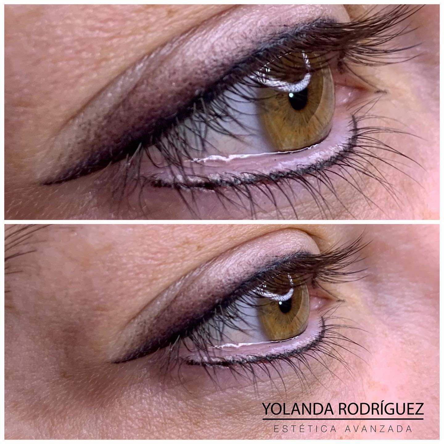 Resultado ojos clienta 3