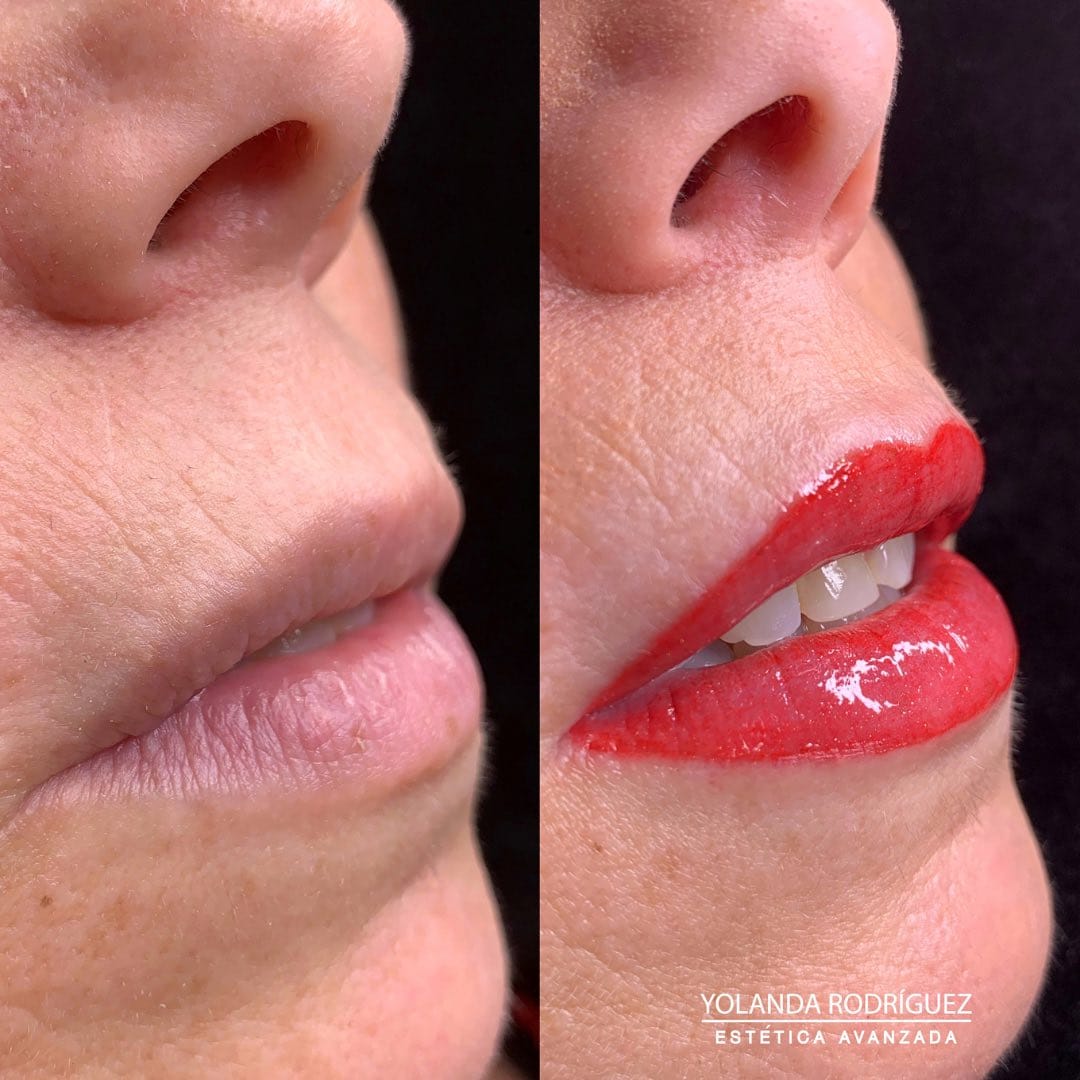 Resultado labios clienta 1