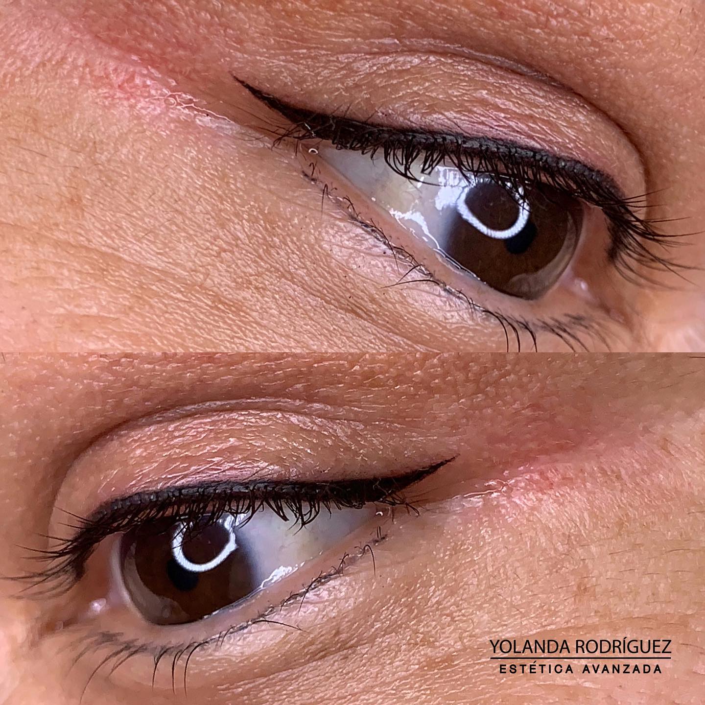 Resultado ojos clienta 1