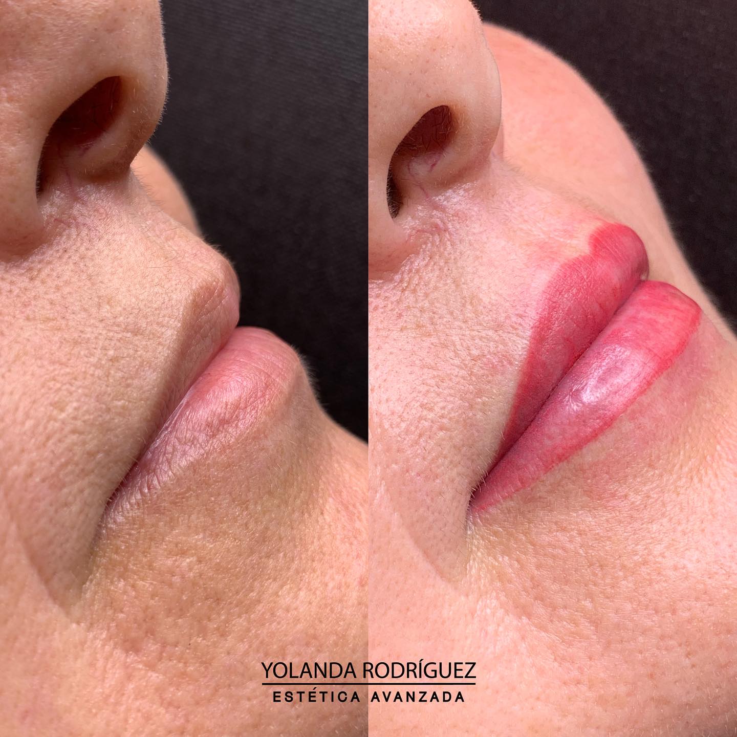 Resultado labios clienta 2