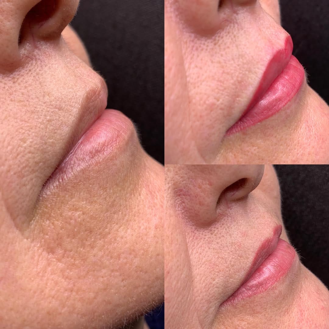 Resultado labios clienta 4