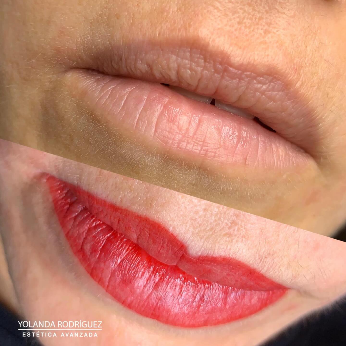 Resultado labios clienta 3