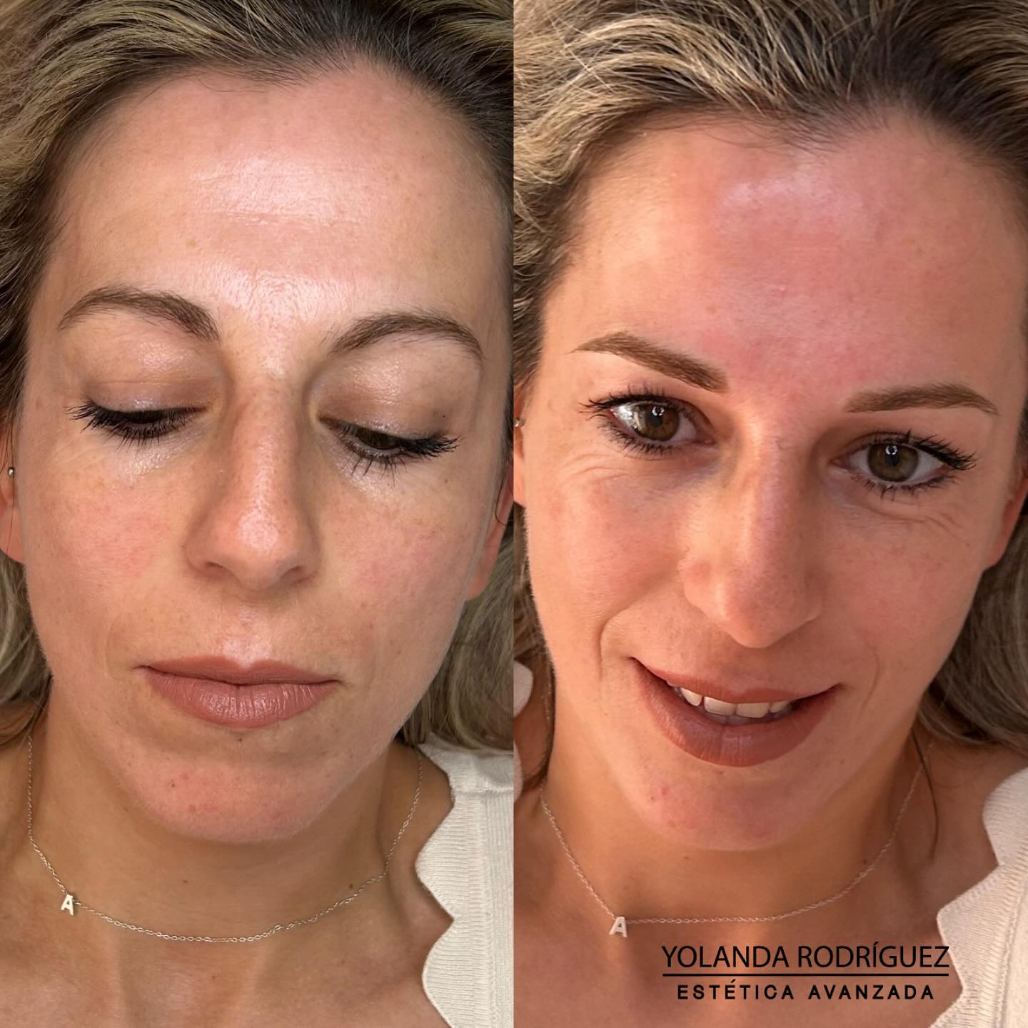 Resultado cejas clienta 1